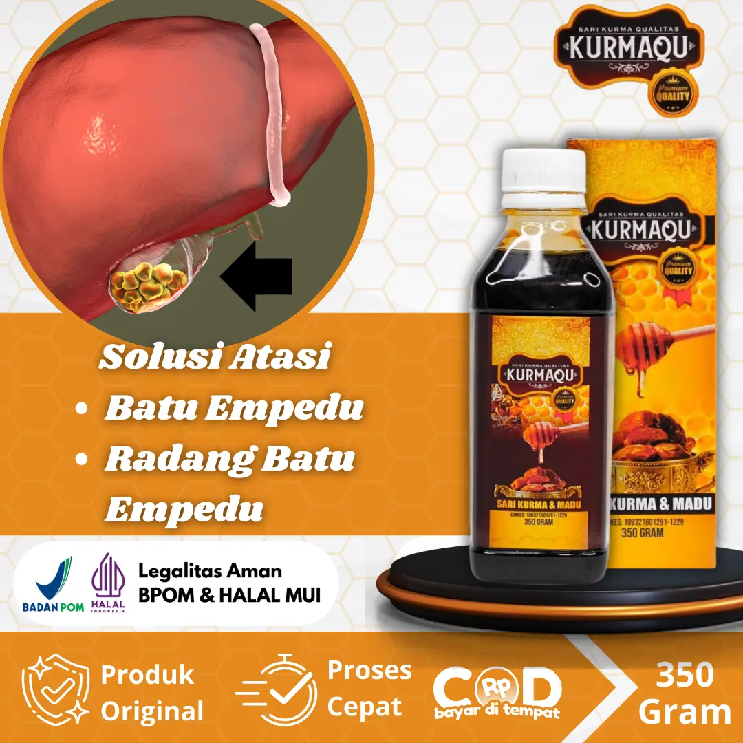 Suplemen Untuk Batu Empedu, Radang Kantung Empedu, Saluran Empedu Tersumbat, Meluruhkan Endapan Kolesterol Dengan Kurmaqu Sari Kurma & Madu
