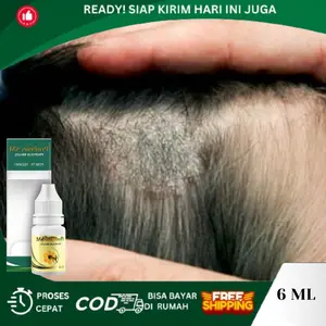 Propolis SM Penghilang Jamur Di Kulit Kepala, Dermatitis Seboroik, Tinea Capitis Di Kepala, Infeksi Jamur Di Kepala, Gatal Kulit Kepala, Borok Di Kepala