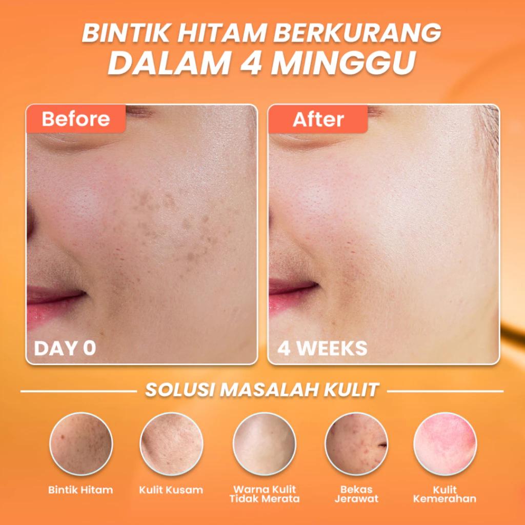 HANASUI Serum Vitamin C Mencerahkan & Pudarkan Bintik Hitam 2% Niacinamide 1% Betadine XX336 HANASUI Serum Vitamin C Mencerahkan & Pudarkan Bintik Hitam 2% Niacinamide 1% Betadine XX336