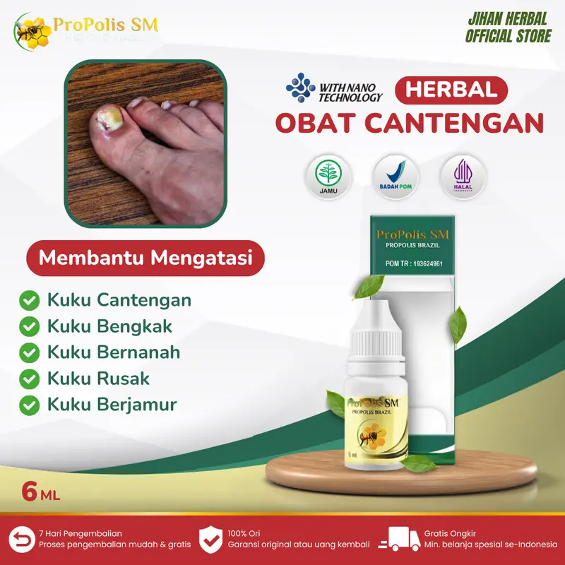 Propolis SM Obat Cantengan Jempol Kaki dan Tangan Perawatan Kuku Bengkak Bernanah Bau Berjamur dan Rusak 0