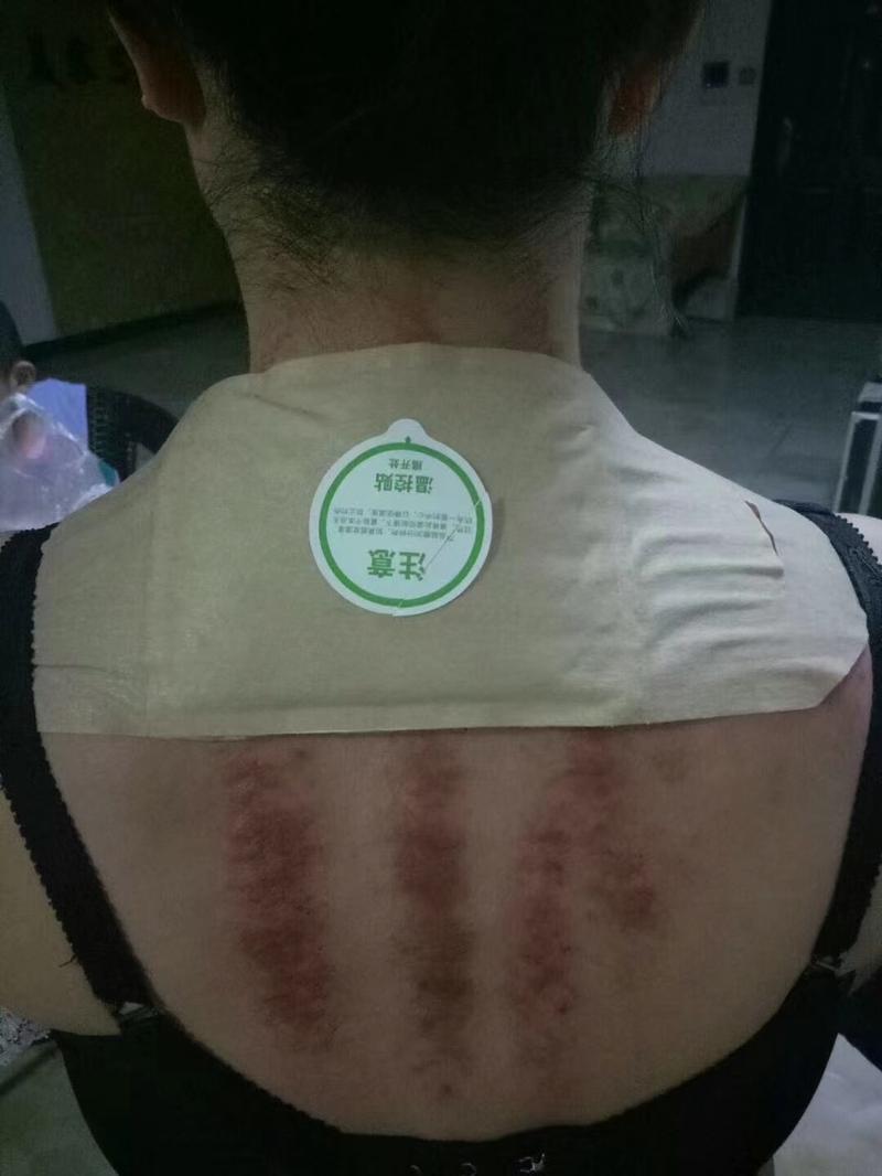 Product Introduction of [TFS Health & Home] MUGWORT WORMWOOD AICAO Pain Relief Heat Pad Paste-on Warm 20