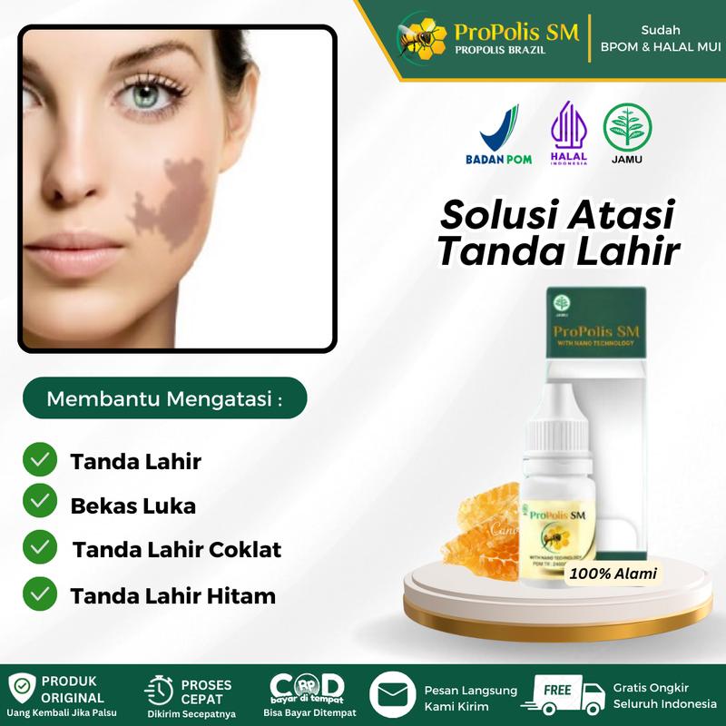 Salep Oles Penghilang Tanda Lahir, Tanda Lahir Coklat / Hitam di  Muka,  Bopeng di Wajah  Atasi Dengan Propolis SM HALAL BPOM 1
