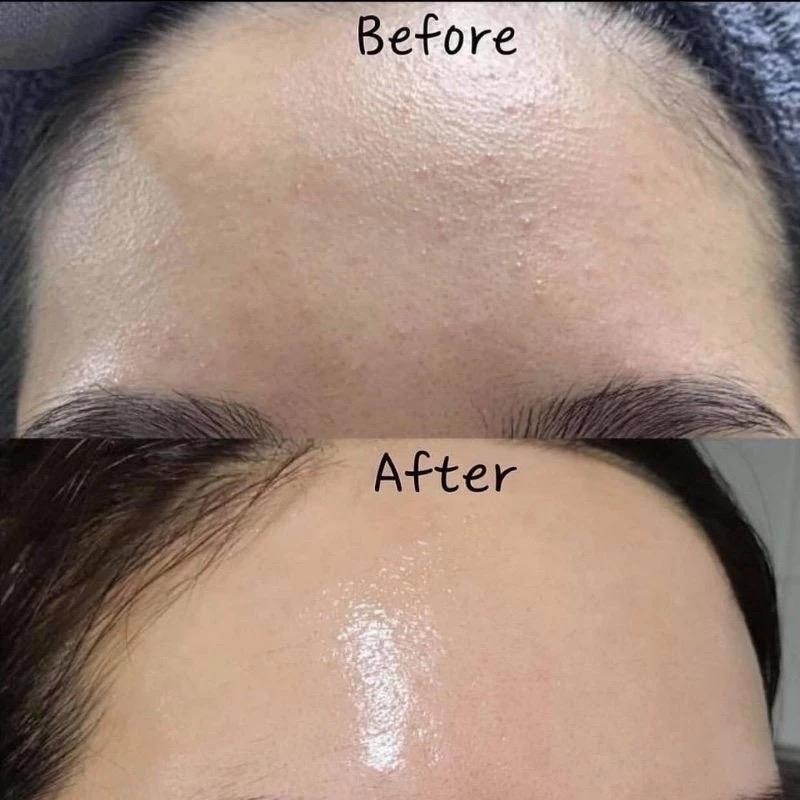 Serum B5 hỗ trợ cấp ẩm phục hồi VLENN 4