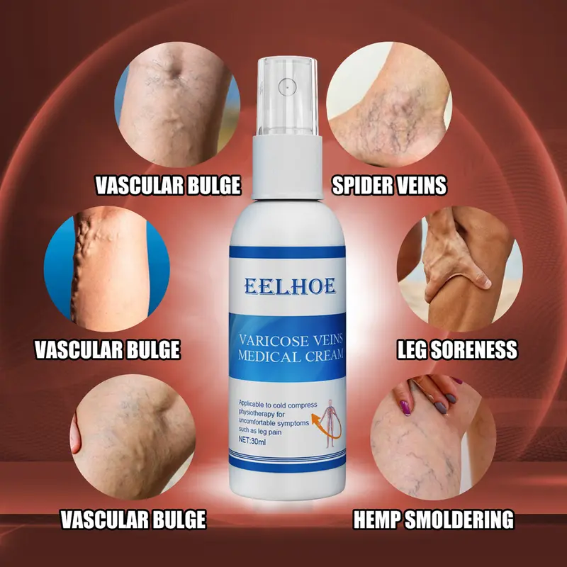 Intravenous massage spray for varicose veins relief and earthworm leg blood vessel bulge pain spray 2