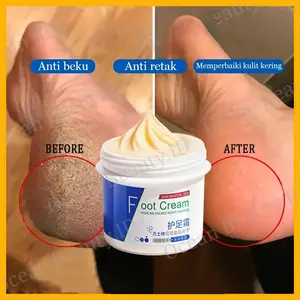 kaki pecah dan kering Foot cream Obat kaki pecah Pelembab kaki kering dan pecah Penghalus kaki kasar dan pecah