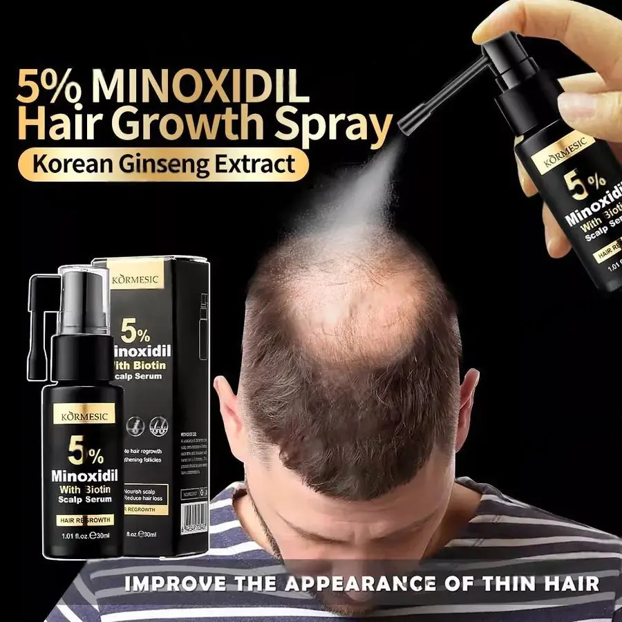 Minoxidil Penumbuh rambut botak Serum penumbuh rambut Obat penumbuh rambut 30ml Penumbuh rambut cepat Hair serum penumbuh rambut Obat penumbuh rambut bayi