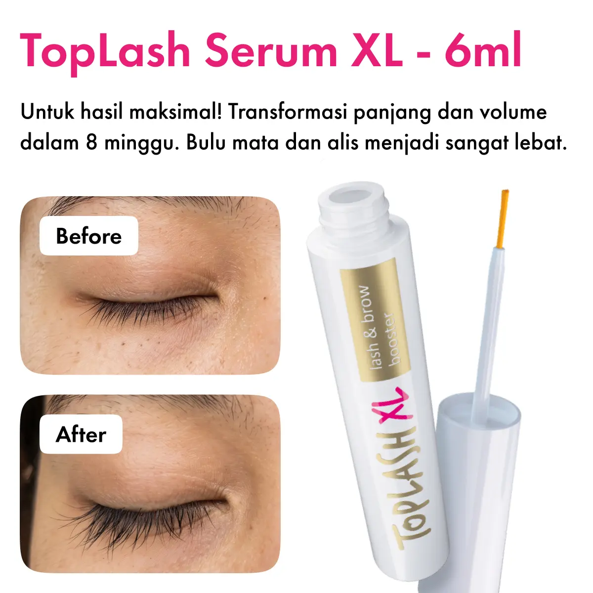 XL 6ml - 8 Minggu