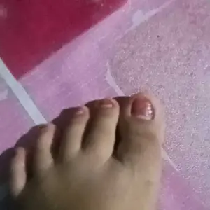 GRATIS ONGKIR Serum Anti Bakteri Serum Merawat Kuku dan Mengatasi Cantengan Bengkak Bernanah Menghitam