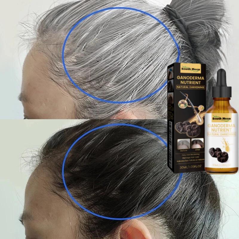 Penghitam rambut Obat uban Menghilangkan uban rambut penghitam rambut serum Rambut Hitam Lebat Herbal Essence Serum penghilang uban permanen - Gel Lidah Buaya