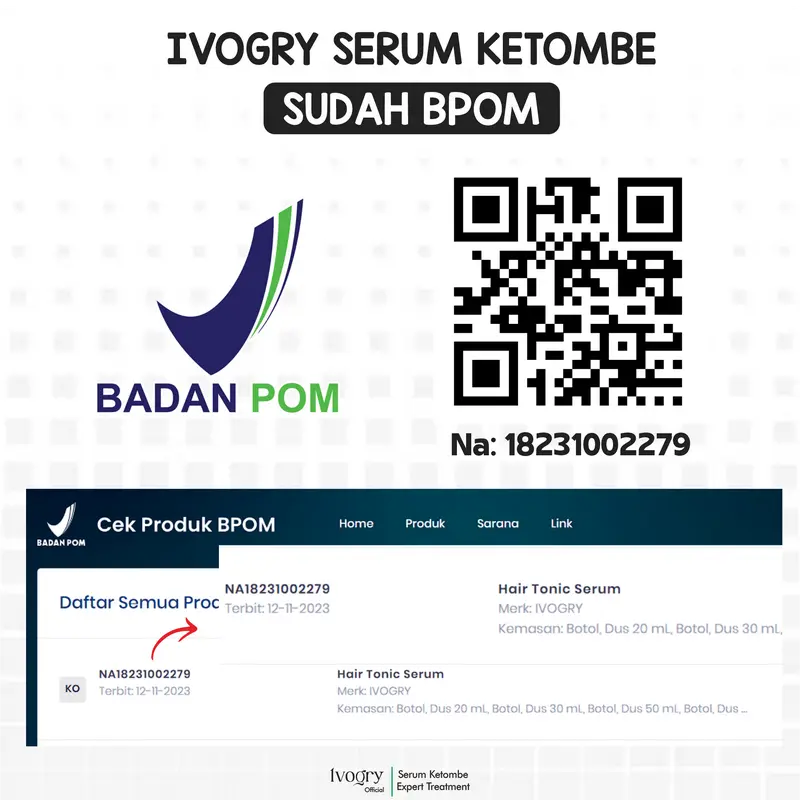 [BUNDLING 2 HEMAT] Ivogry Serum Anti Ketombe | Hair Serum Tonic Anti Dandruff Expert Treatment 50ml | Bergaransi  Ketombe Hilang Gatal Kering Perempuan Laki-Laki Haircare Tetes Psoriasis 1