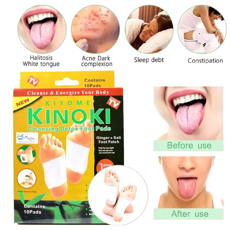 Koyo Kaki Kinoki Putih 1 Box isi 10pcs Koyo Kesehatan Ampuh Menghilangkan Racun Tubuh Kinoki Gold 1 Box Tangan & Kaki - Hand, Foot 0