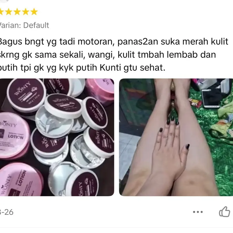 WONIY LOTION (siang & malam) lotion strong BPOM NIACINAMIDE ALPHA ARBUTIN 2