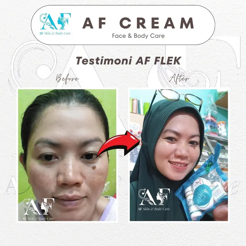 Cream Flek Af Glowing by Owner Abhel 4