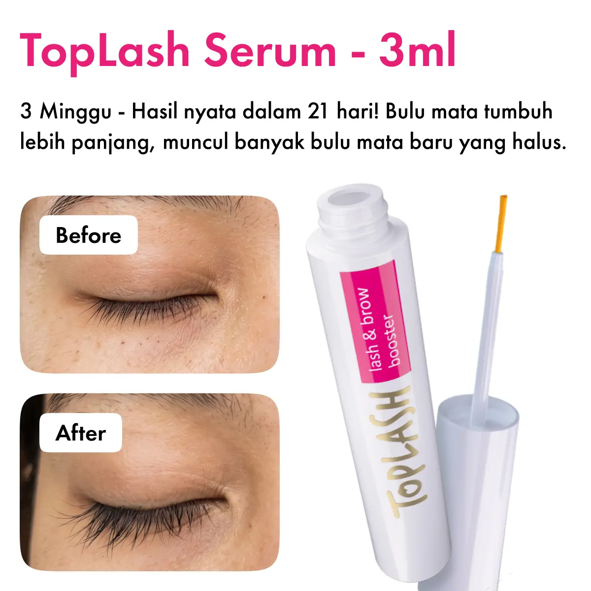 Normal 3ml - 3 Minggu