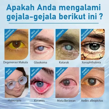 Lutein Perawatan mata Meredakan Kelelahan Mata/Tetes Mata Lutein/Mata Kering Dan Mata Astringen Presbyopia Eye Drops Relieve Eye Fatigue And Relieve Dry Eyes. 1