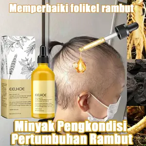 rosemary oil rambut penumbuh rambut botak penebal rambut penumbuh rambut cepat anti rontok rambut