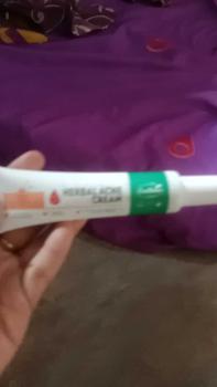 Product Review of （T1）BPOM.Beli 2 Gratis 1.Challenge 7 Hari Jerawat Hilang,CINSULIN Obat Jerawat Herbal Ekstrak Alami Cepat Hilangkan Komedo & Jerawat Meradang  BPOM Certified  Aman untuk Remaja & Kulit Sensitif Berjerawat Wajah Gatal Beruntusan from u**6 0
