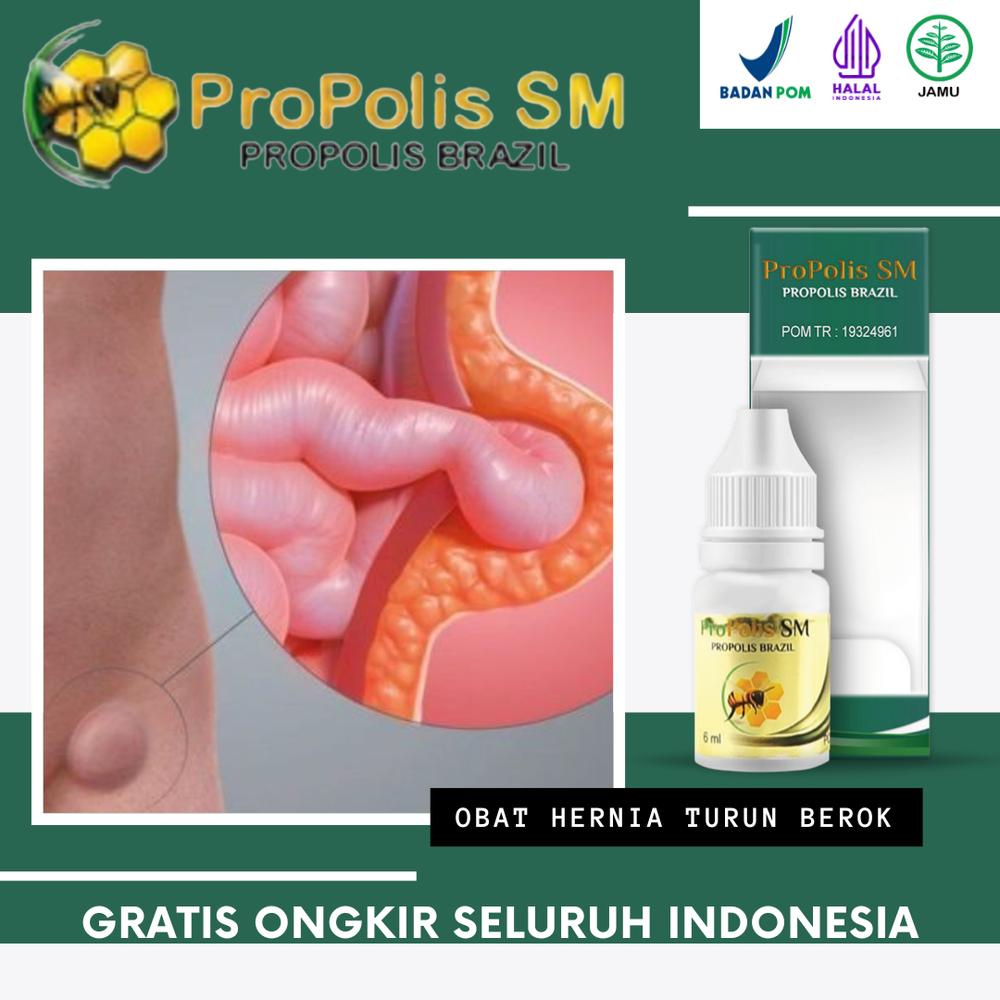 Propolis SM Mengatasi Turun Berok, Hernia, Benjolan di Perut, Hernia Turun Berok Atasi Dengan Propolis SM HALAL BPOM