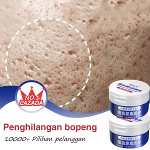 penghilang bekas Krim wajah 100g lubang jerawat Penghilang Bopeng Krim wajah Penghilang Flek Hitam Kusam vitamin E Krim pelembab vitamin E