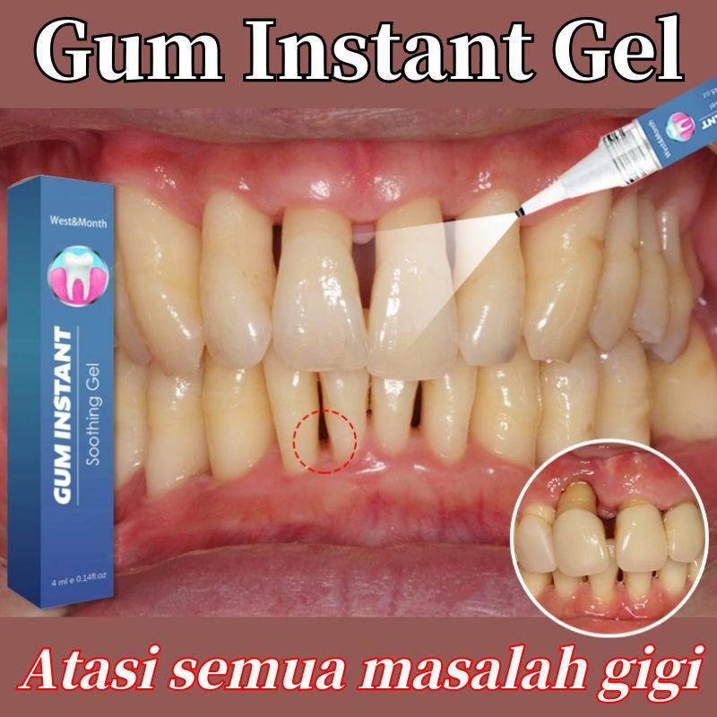Gum instant untuk gigi Gum care Gel perawatan gusi Penguat gigi pemutih gigi Penghilang karang gigi Meredakan pembengkakan dan nyeri resesi gusi membersihkan noda plak - 4ml