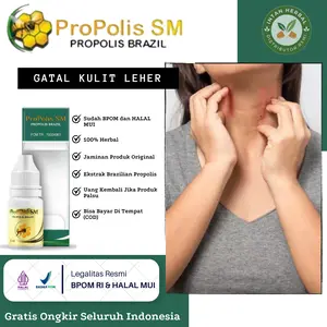 Propolis SM Mengatasi Gatal Kulit Leher, Ruam di Leher, Bintik Merah, Bruntusan Pada Leher, Leher Hitam Atasi Dengan Propolis SM HALAL BPOM