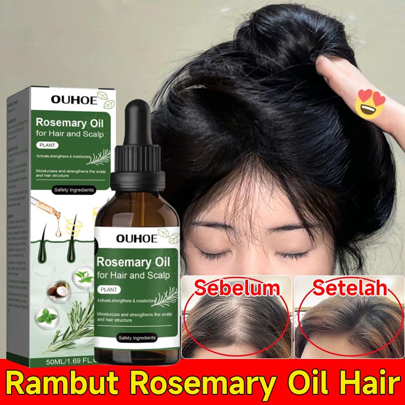 Serum Perawatan Rambut Botak Hair Growth Rosemary Oil Untuk Penebal ...