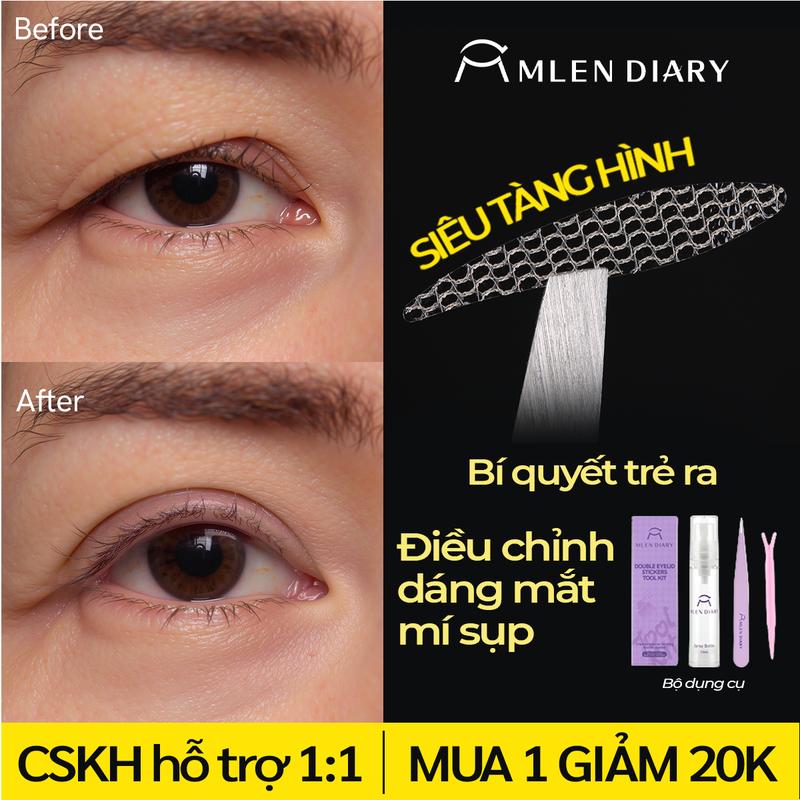 [Mua 1 hộp giảm 20K] Mlen Diary - Miếng Dán Kích Mí Lưới Tàng Hình Tự Nhiên Phù Hợp Cho Mọi Dáng Mắt, Nhiều Lựa Chọn Dễ Dùng Cho Người Mới Bắt Đầu, Kích Mí Không Gây Lộ, Tự Nhiên Cả Khi Không Makeup