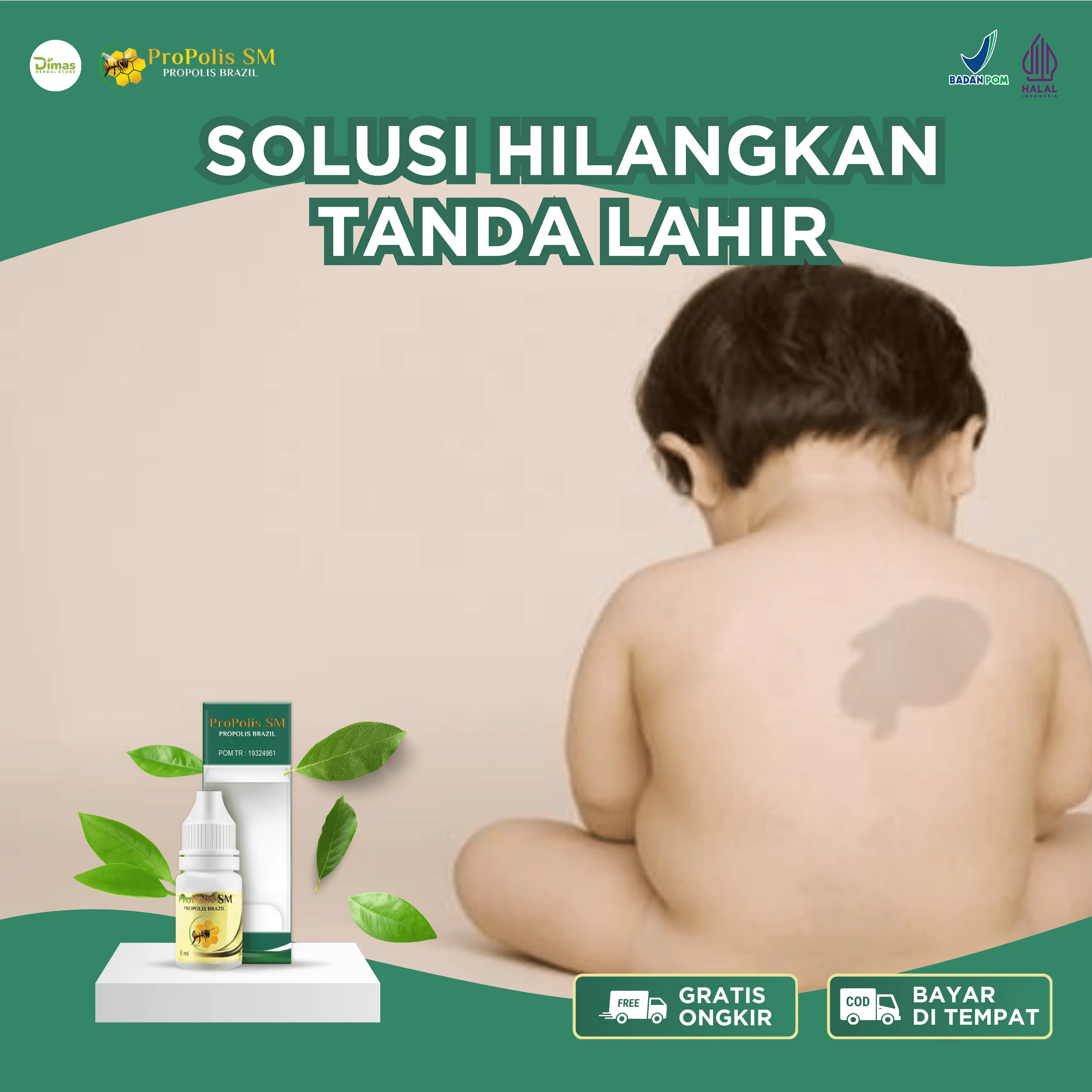 Penghilang Tanda Lahir, Tanda Lahir Di Muka, Tanda Lahir Coklat, Tanda Lahir Merah, Menghilangkan Tanda Lahir Untuk Anak Dan Dewasa Dengan Propolis SM