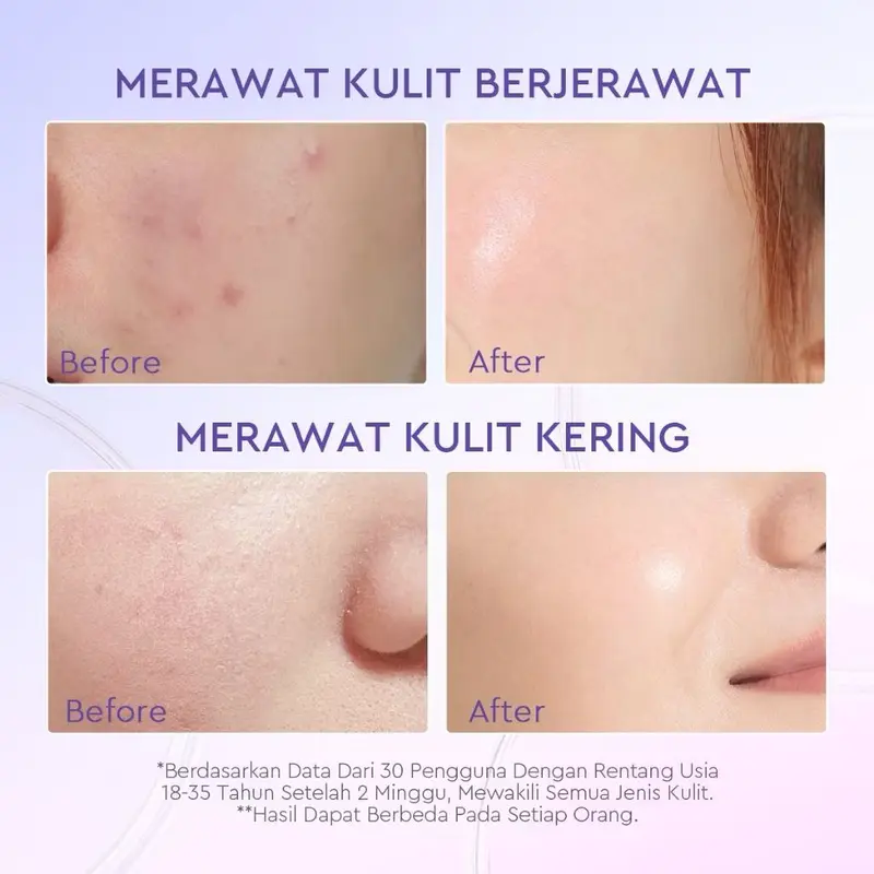 BUNDLE 3 Glad2Glow Blueberry Moisturizer Cream 5x Ceramide Skin Barrier Repair 30 gram 4