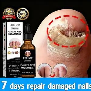 Herbal Nail Repair Diskon 30ml Cairan Perbaikan Infeksi Jamur Kuku Kaki untuk Onychomycosis Kualitas Tinggi Aman Tanpa Rasa Sakit