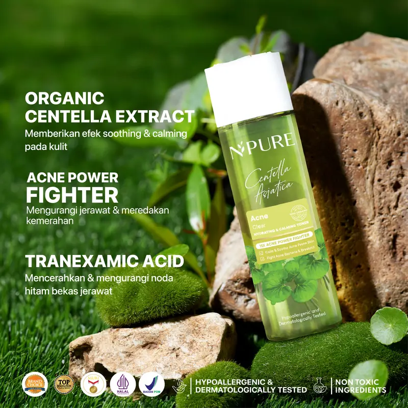 【Exclusive Ygrianii】Twinpack Toner NPURE Acne Face Toner Centella Asiatica 150 ml / Toner Kulit Berjerawat / Hydrating Toner Mencerahkan Wajah  Beruntusan Komedo Kotoran 1