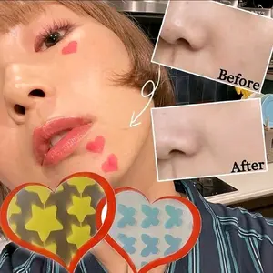 ACNE PATCH/PIMPLE PATCH Motif Bintang Menghilangkan Jerawat (Isi 28 pcs)