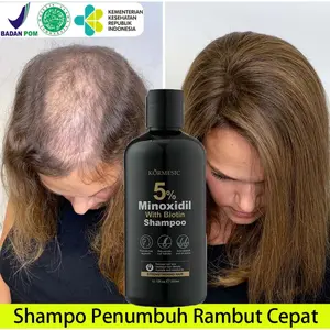 Shampo penumbuh rambut minoxidil 5% Shampo rambut rontok Mencegah Shampoo Penumbuh Rambut Cepat Mengontrol minyak dan ketombe Menghilangkan tungau Shampoo 300ml
