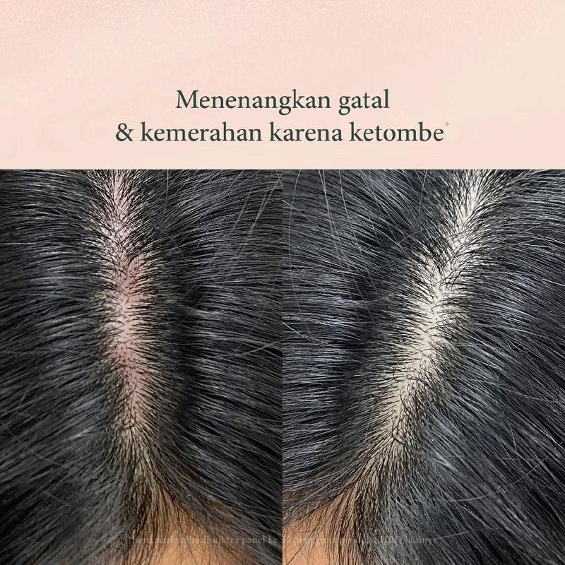 SHRD Nutra Therapy Keratin Shampoo Perawatan Rambut Rontok Lepek Oil Control Conditioner Haircare Ketombe Sampo Kering Penghitam Vitamin Extract Berminyak 3
