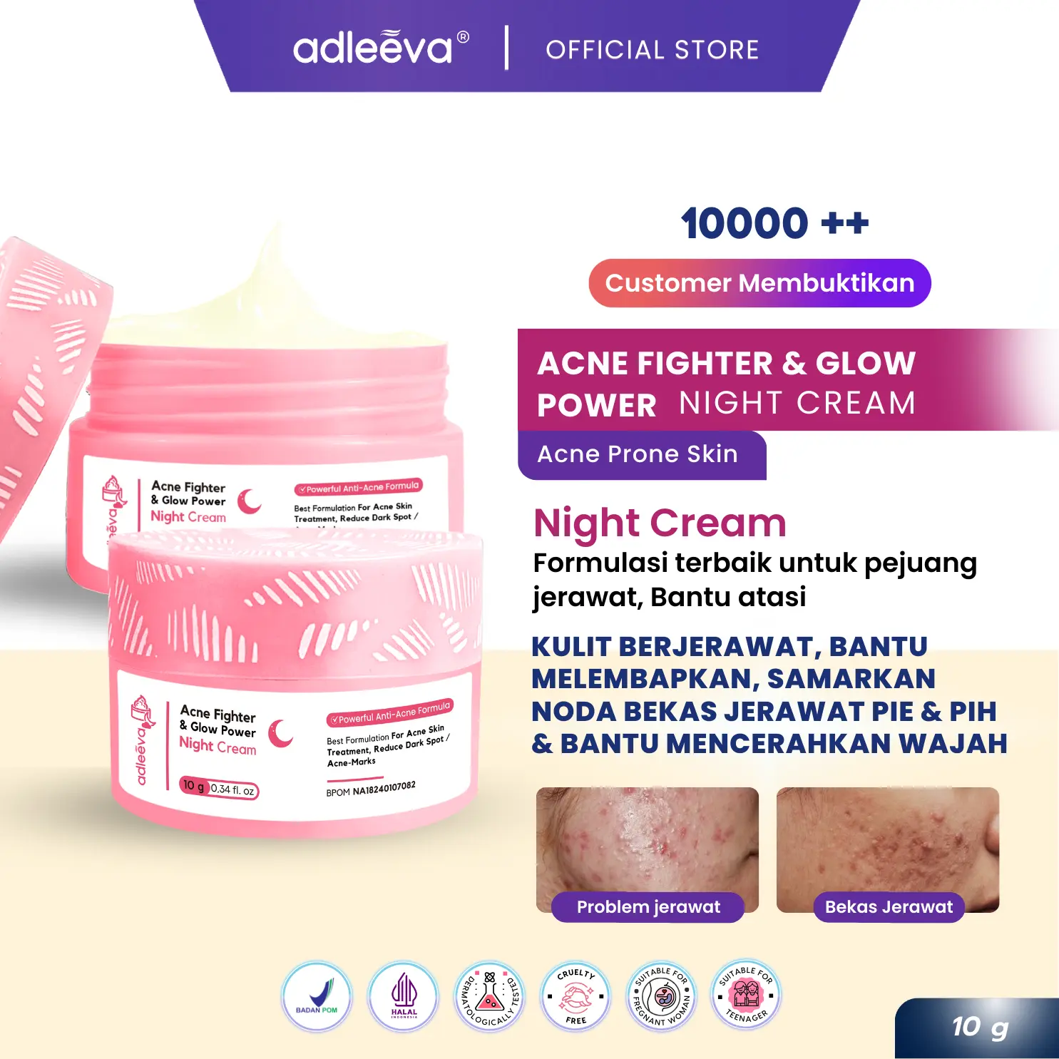 ADLEEVA Night Cream Acne Fighter & Glow Power - Membantu merawat kulit berjerawat & bruntusan dan menyamarkan bekas jerawat