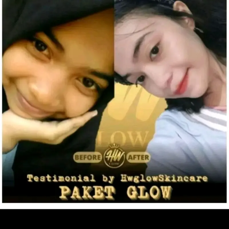 Skincare HW Glow, paket glow, 1 paket free parfum, mencerahkan dan memutihkan 2