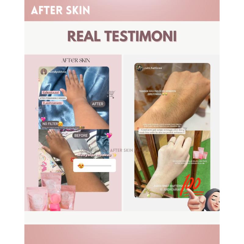 ( BELI 2 GRATIS 1 )AFTER SKIN ALPHA ARBUTIN COLLAGEN BRIGHTENING BODY WASH BAR SOAP 60GR SABUN MANDI PENCERAH PEMUTIH Hand Mencerahkan Lightening Cair Tangan 5