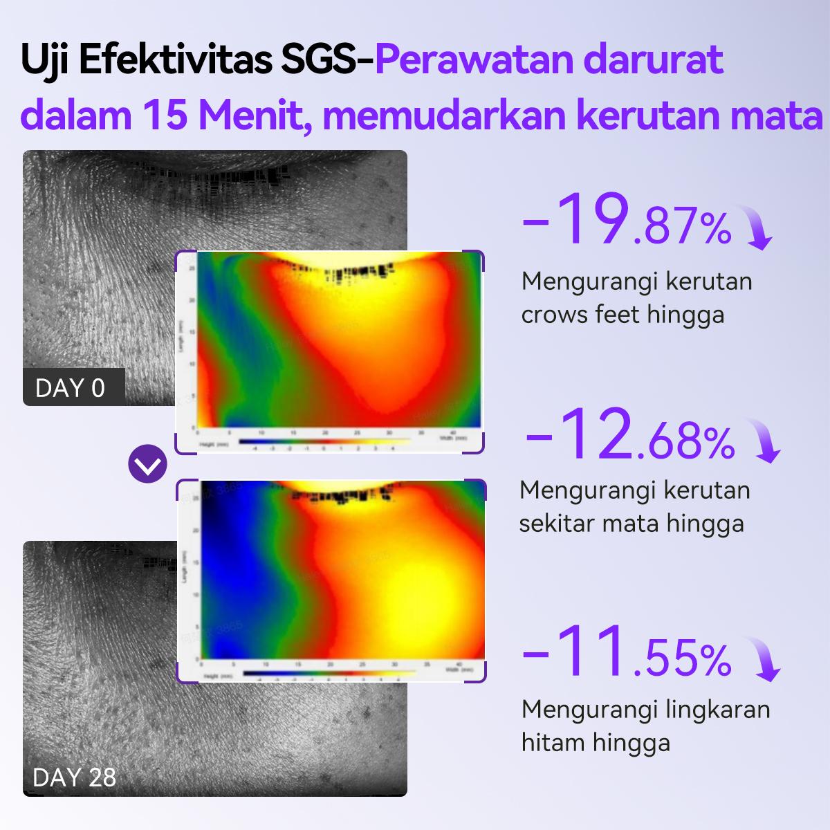 [HOT][BPOM] LANBENA Retinol Eye Patches 60Pcs | 5X Anti-Aging SGS Tested | 15 Menit Kurangi Garis Halus & Lingkaran Hitam | Gel Biomimetik Dingin Mata Bengkak Kantung Mata Anti Kerut