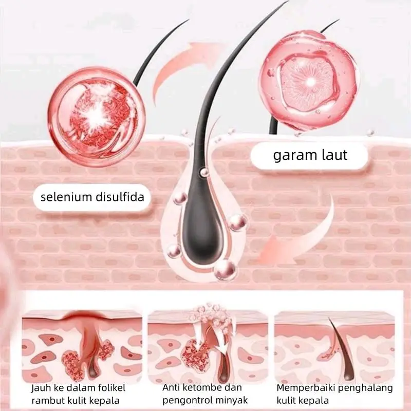 ( HEMAT ISI 2 BOTOL ) NIPPORI Selenium  Disulfide Haircare Shampoo Helps control oil and reduce dandruff Membantu mengontrol minyak dan mengurangi ketombe Gatal Perawatan Sampo 300ML 5