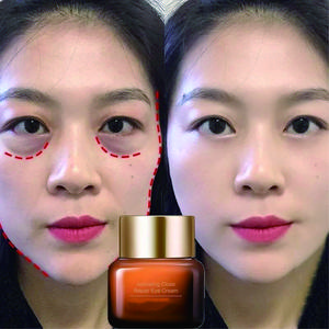 eye cream krim mata panda penghilang kantung mata 20g Menghilangkan Kantong Mata Lingkaran Hitam Anti Kerut Anti Penuaan Pelembab Mengencangkan Kulit Mencerahkan Kosmetik