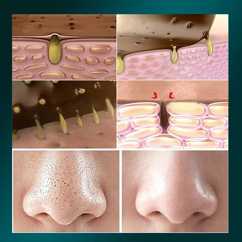 Pembersih Wajah Pria 160ML Pemutih Wajah Anti Acne Face Wash Komedo Kontrol Minyak Melembabkan Ringan Dan Tidak Mengiritasi Pori-pori Bersih Dalam Perawatan Berjerawat 5