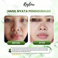 Gambar Reglow dr Shindy Cleanser Facial Wash Membersihkan Kotoran Wajah Sabun Cuci Muka Kulit Berminyak Berjerawat - FACIAL WASH dari Biliva Beauty Store Kota Surabaya 4 Tokopedia