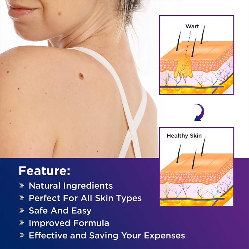 Product Introduction of Jemeesen Natural Herbal Skincare Wart Acne Remover Remove Warts Heal Skin Gentle & Effective Solution Plant Based Relief Skin Repair Skincare Acne 2