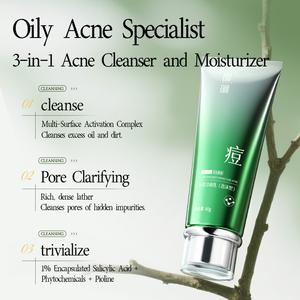 Fupei anti acne foaming cleanser for oily skin pimples acne scars redness blackheads soothing refreshing gentle skincare try this today fasha beauty