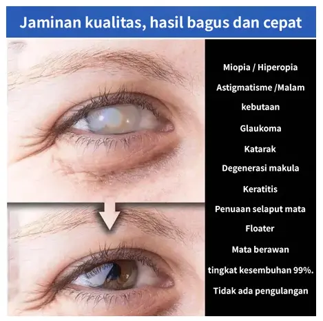 Perawatan Mata Cairan Brightening Liquid Eye Care 8