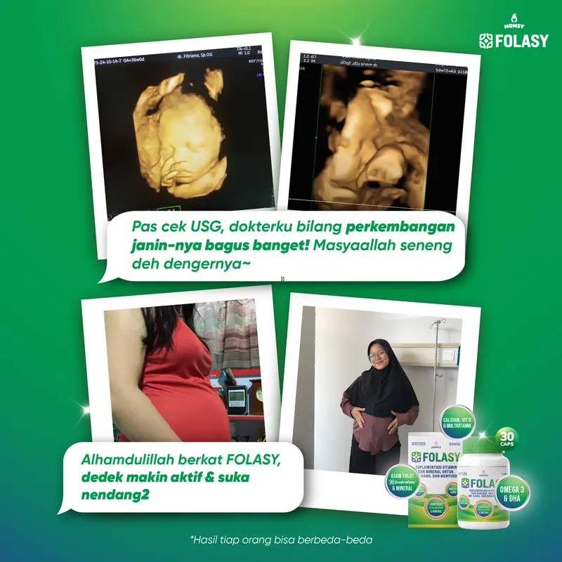FOLASY [FOLAT AKTIF] [FREE ONGKIR}Lengkap Dengan 20 Nutrisi Esensial Bumil Kalsium, Magnesium, DHA, Omega 3, Vitamin A-K 3