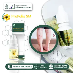 Propolis SM untuk Gatal Budug Bernanah Scabies Darah Manis Anak dan Dewasa isi 6 ml