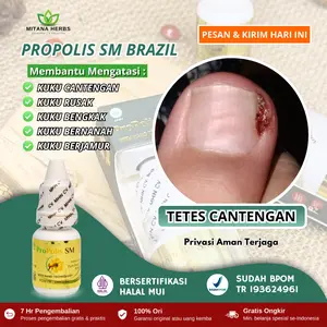 Obat Tetes Kuku Cantengan Jempol Kaki Bengkak Bernanah Kuku Rusak Berjamur Propolis SM Perawatan Kuku Nail Wanita