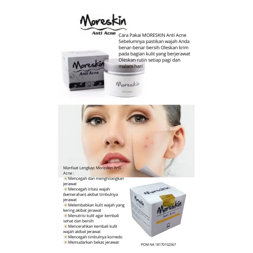 MORISKIN ANTI ACNE NASA/xacne nasa- Krim penghilang jerawat - menyembuhkan jerawat - original nasa Acid Perawatan