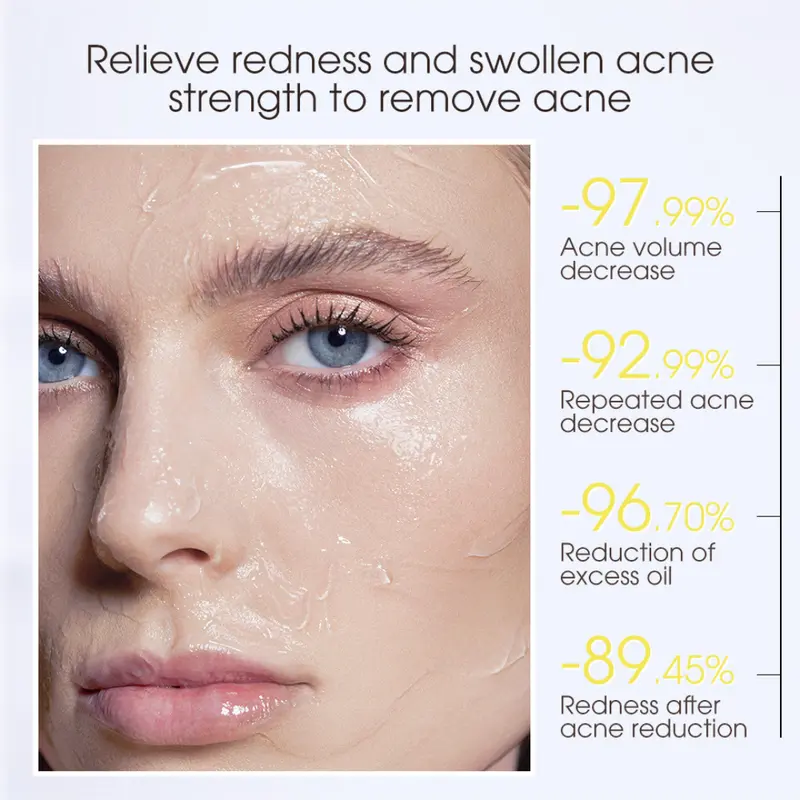 SKINEVER Salicylic Acid Acne Treatment Sleep Mask Centella Soothing Mask Brightening Sunscreen 3ml pembersih wajah berjerawat 6
